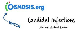 Candidal Infections Osmosis Study Video [upl. by Claiborn]