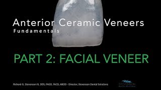 Anterior Ceramic Veneers Part 2 Facial Veneer [upl. by Vtehsta396]