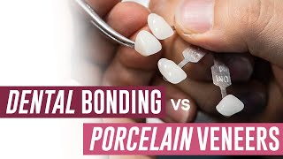 Dental Bonding vs Porcelain Veneers  Which Should I Get [upl. by Janene]