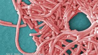 Legionnaires Disease What You Need to Know [upl. by Yderf]