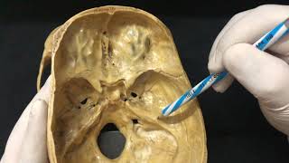 Skull Osteology  Cranial Cavity Anatomy [upl. by Nannie]