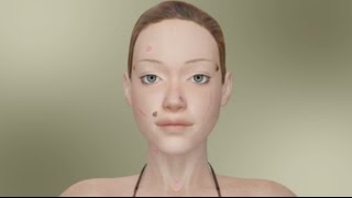 10 Ways To Remove Facial Skin Lesions [upl. by Auqenaj]