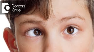 How to control Strabismus Lazy Eye [upl. by Navad]