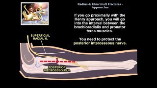 Radius amp Ulnar Shaft Fracture Approaches  Everything You Need To Know  Dr Nabil Ebraheim [upl. by Keithley]