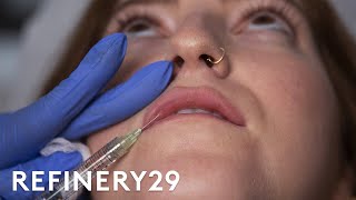 I Got Lip Filler Injections For The First Time  Macro Beauty  Refinery29 [upl. by Ier762]