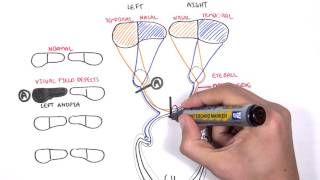 Visual Pathway and Lesions [upl. by Giavani]