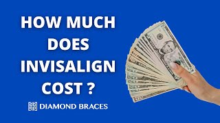 How Much Does Invisalign Cost [upl. by Ased]