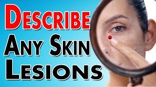 Describing Skin Lesions [upl. by Acino]