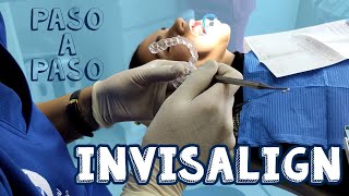 Ortodoncia invisible invisalign│Paso a Paso [upl. by Towroy]