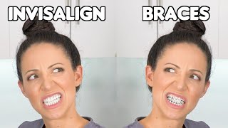 Braces or Invisalign Which is BETTER [upl. by Adnovay]