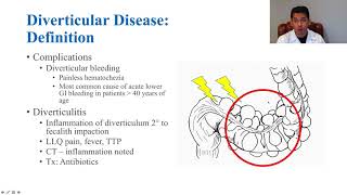 Should I Avoid Seeds amp Nuts with Diverticulitis – Dr Berg [upl. by Chryste702]