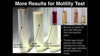 Microbiology Motility Test [upl. by Lauryn]