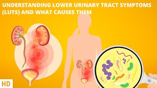 Understanding Lower Urinary Tract Symptoms [upl. by Yaker990]