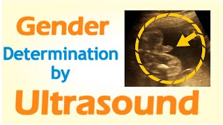 Gender Determination by Ultrasound [upl. by Adon]