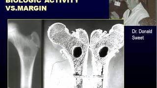 Radiographic Approach to Bone Lesions Part I [upl. by Bough4]