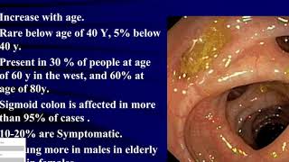 CLINIC How to heal Diverticulitis naturally [upl. by Sulecram923]