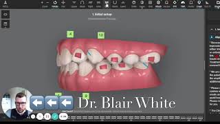 The Invisalign® ClinCheck Process [upl. by Grigson]